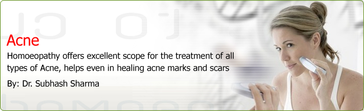 treatingacne | topacnetreatments